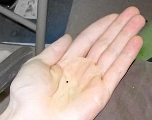 Mustard-Seed-Potential